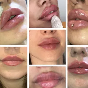 Bild von PrettyDoc Düsseldorf - Hyaluron und Botox Düsseldorf