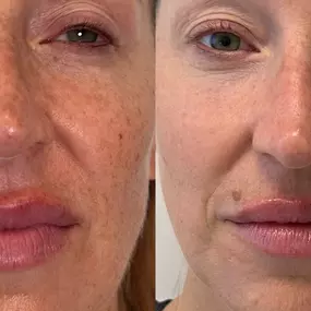 Bild von Infinity Beauty Lab Med Spa