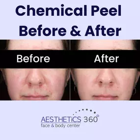 Bild von AESTHETICS 360° Face & Body Center