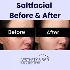 Bild von AESTHETICS 360° Face & Body Center
