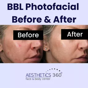 Bild von AESTHETICS 360° Face & Body Center