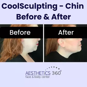 Bild von AESTHETICS 360° Face & Body Center