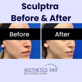 Bild von AESTHETICS 360° Face & Body Center