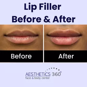 Bild von AESTHETICS 360° Face & Body Center