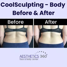 Bild von AESTHETICS 360° Face & Body Center
