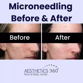 Bild von AESTHETICS 360° Face & Body Center