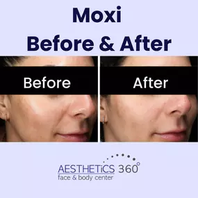 Bild von AESTHETICS 360° Face & Body Center