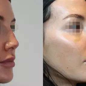 Bild von Reza Nassab Plastic Surgery Manchester