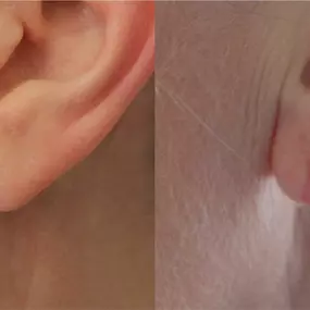 Bild von Reza Nassab Plastic Surgery Manchester