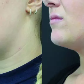 Bild von Reza Nassab Plastic Surgery Manchester