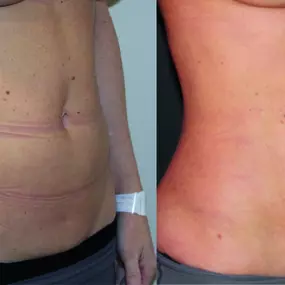 Bild von Reza Nassab Plastic Surgery Manchester