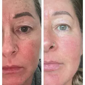 Bild von Vale Laser Aesthetics