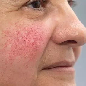Bild von Vale Laser Aesthetics