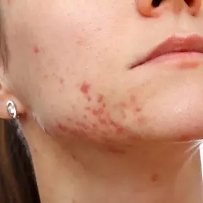 Bild von Vale Laser Aesthetics