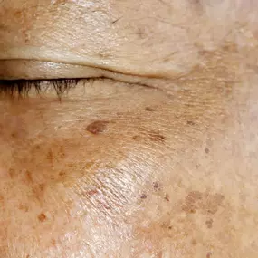 Bild von Vale Laser Aesthetics