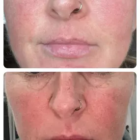 Bild von Vale Laser Aesthetics