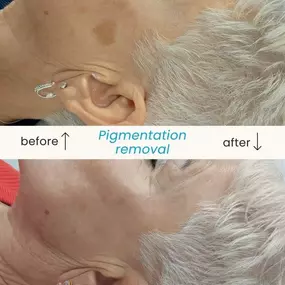 Bild von Vale Laser Aesthetics