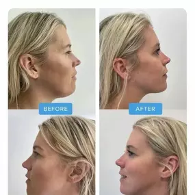 Bild von Vale Laser Aesthetics