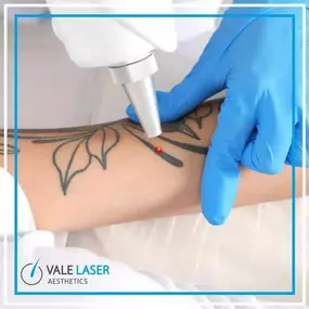 Bild von Vale Laser Aesthetics