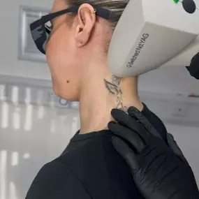 Bild von Vale Laser Aesthetics