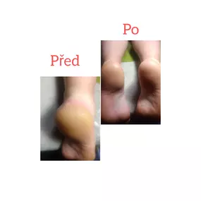 Bild von Masáže - pedikúra Alice Musilová Brno