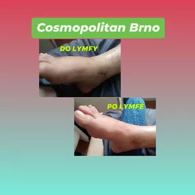 Bild von Masáže - pedikúra Alice Musilová Brno