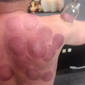 Bild von Masáže - pedikúra Alice Musilová Brno