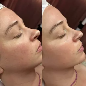 Bild von Bisous Esthetics