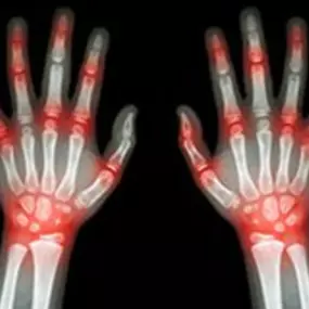 Bild von QC Kinetix (Exton)