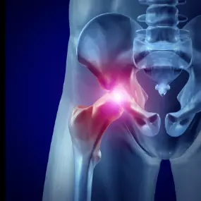 Bild von QC Kinetix (Exton)