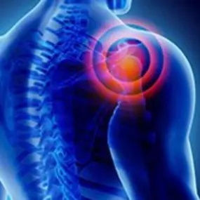 Bild von QC Kinetix (Exton)