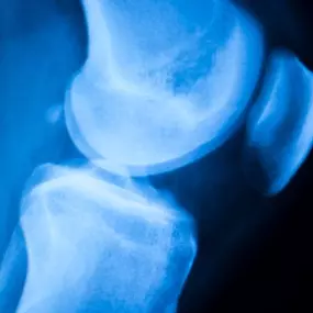 Bild von QC Kinetix (Exton)