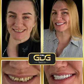 Bild von GDG Smiles