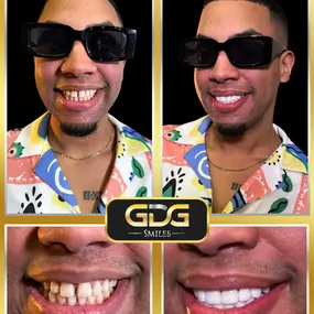 Bild von GDG Smiles