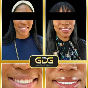 Bild von GDG Smiles