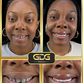 Bild von GDG Smiles