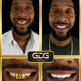 Bild von GDG Smiles