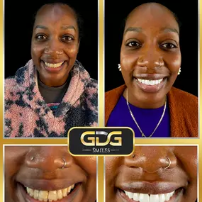 Bild von GDG Smiles