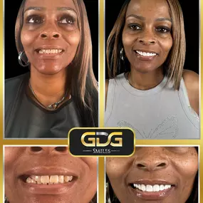 Bild von GDG Smiles
