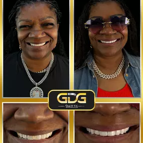 Bild von GDG Smiles