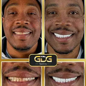 Bild von GDG Smiles