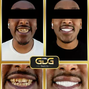 Bild von GDG Smiles