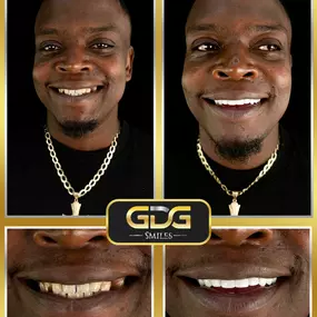 Bild von GDG Smiles