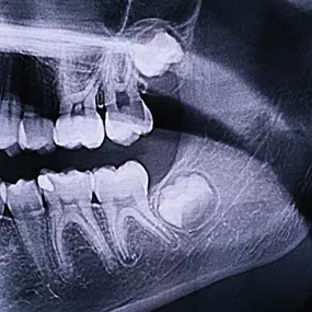 Bild von Zahnarzt Dr. med. dent. Thomas Schulz