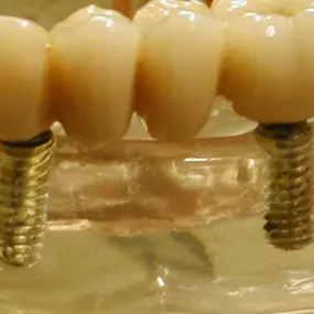 Bild von Zahnarzt Dr. med. dent. Thomas Schulz