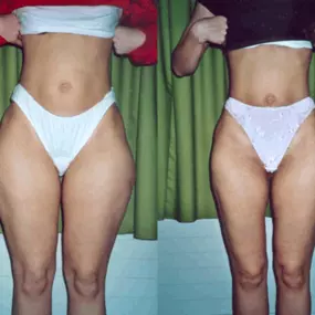 Bild von Medical Aesthetic Fettabsaugen Dr. Urs Benz