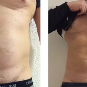 Bild von Medical Aesthetic Fettabsaugen Dr. Urs Benz