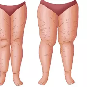Bild von Medical Aesthetic Fettabsaugen Dr. Urs Benz