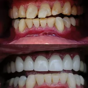 Best Cosmetic Dentist in Woodland Hills
