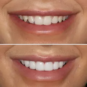 Bild von Smiles By Eddie: Dr. Edmond Ahdoot DDS
